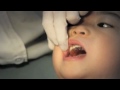 www.discountdentalbraces.com. Retainer was use to straightening his teeth without braces. Orthodontic treatment. . Our office number is 281.568.1270