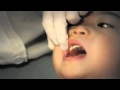 Houston Dentist- Kid receiving first retainer while listening to Techno Music