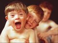 Down syndrome:&nbsp;Sindrome de Down preconceito
