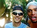 Fratura-exposta-jack