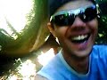 Fratura-exposta-jack