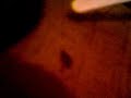 Retard with bug Retard with bug