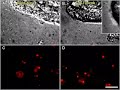 Dysfunction cilia