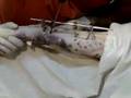 videos de Colocación del cuarto clavo