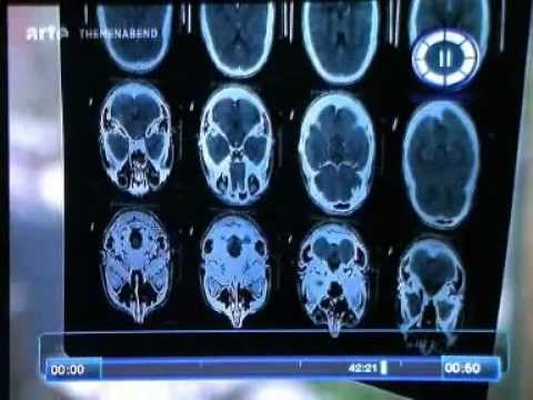 Imagen de previsualización de YouTube