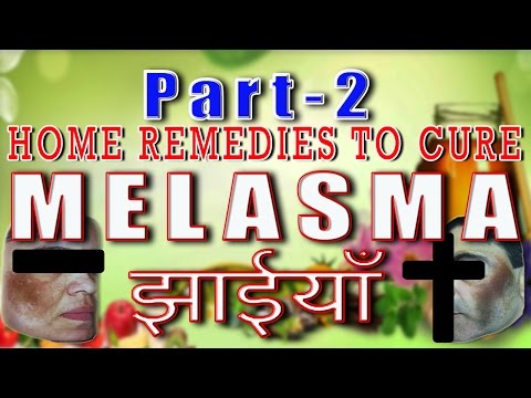 how to care melasma