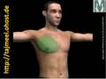 Gynecomastia (ARABIC) د. محمد الروبى تصغير الثدى للرجال
