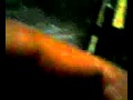 sadam husain in Anesthesia 2010.avi