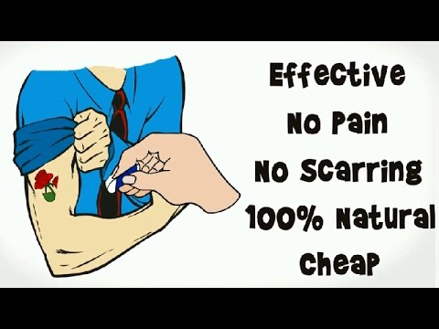 How to Get Rid of Tattoos Fast Naturally at Home – Mens and Healthy Life