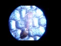Pharaoh ant under a microscope