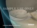 The CrossFix™ System All Inside Technique with Inside Out Results