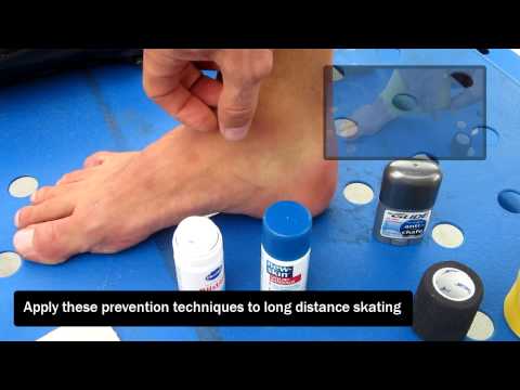 how to treat a blister on a foot