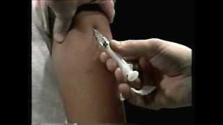 Técnica correcta de aplicar inyecciones intradérmicas y subcutáneas...