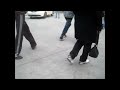 Jump Knee Gait with Sligh Tendency for Scissoring