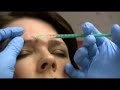 Cosmetic Botox : Dr. Brett Kotlus Cosmetic Botox : Dr. Brett Kotlus