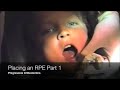 placing an rpe part 1