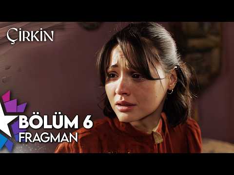 Çirkin 6. Bölüm Fragmanı                                                                                                                                                                                                                                  
