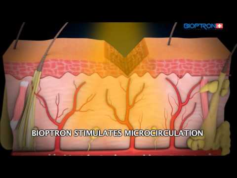how to relieve wound pain