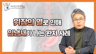 위열, 잇몸출혈 그리고 입냄새