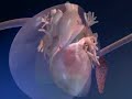Medical Visualization Demo Reel