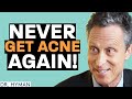 How to get rid of acne, pimples and other skin problems..