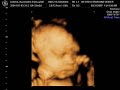 OUR BABY