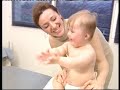Down syndrome:&nbsp;S�ndrome de Down
