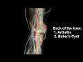 location of Knee pain by Farshchian