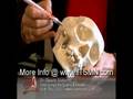 Craniofacial Pain and Headaches