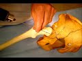 Treatment of Acetabular fractures with an Ilizarov Frame