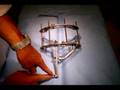Treatment of Acetabular fractures with an Ilizarov Frame