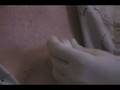 videos de Mole removal