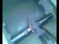 essilor 900mx prfilscan make 1.67 lens