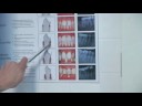 Teeth Whitening : Dental Health: Smoking  Gums