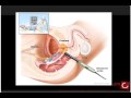 What's new at the American Urological Association (AUA) 2009 urology603