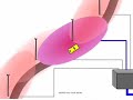 cellular-emergency-alert-system.html