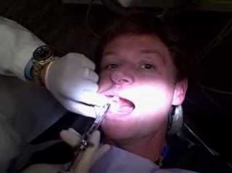 how to relieve novocaine numbness