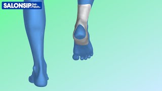 阿基利斯腱