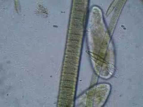 Ciliate Protozoa Wander Around the ...