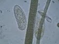 Ciliate Protozoa Wander Around the Salt Pond