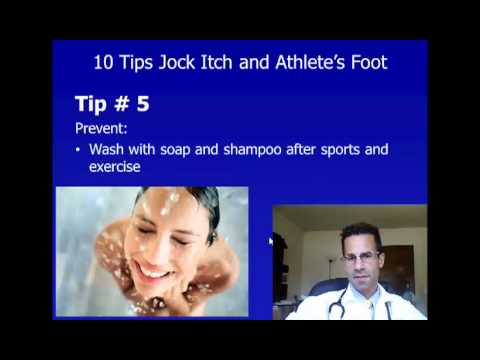 how to relieve athlete's foot itch