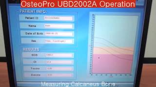 video thumbnail [bmtech] Ultrasound bone densitometer  youtube