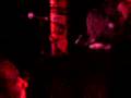 The Matches - Sunburn VS The Rhinovirus (Live At El Corazon)