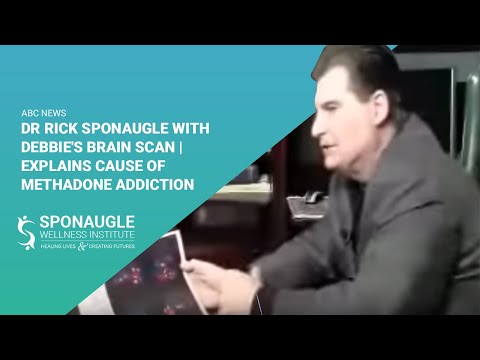 how to cure xanax addiction