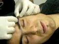 Piercing surface eyebrow de mi ceja izquierda