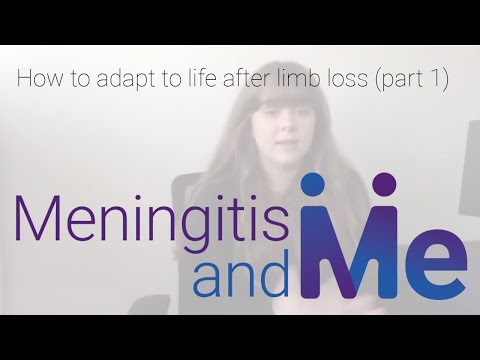 How to adapt to life after limb loss (part 1)