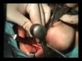 MAXILOFACIAL DAVID BARRIENTOS SOLORIO