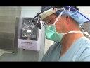 UCLA Health System: A Surgical Option for Treating Sturge-Weber Syndrome
