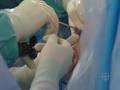 Hip Arthroscopy