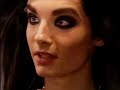 bill-kaulitz-hat-op-berstanden-.html